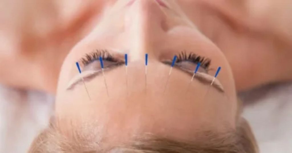 anxiety in chinese medicine